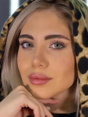 لنز رنگی  ایفوریا