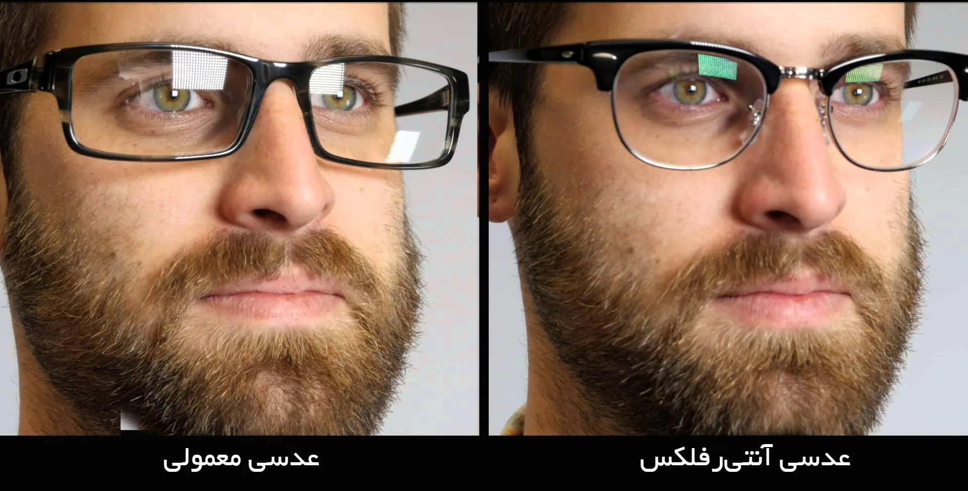 پوشش‌ عدسی عینک