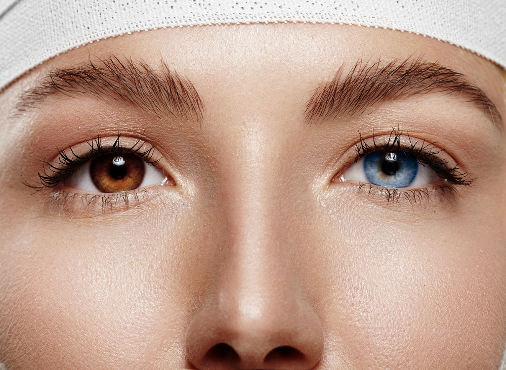 استفاده از لنز پس از لیزیک