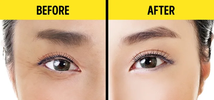از بین بردن چروک دور چشم‌ ها و جوانسازی صورت با یک ماساژ ژاپنی ساده