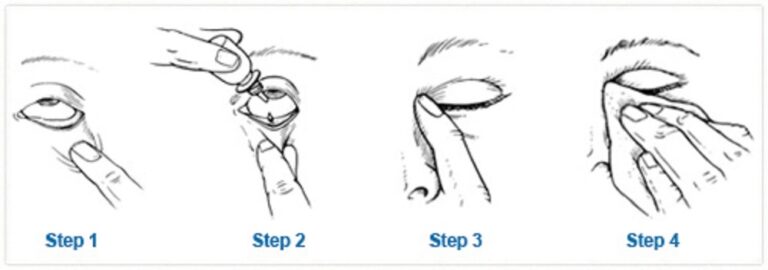 چگونه در چشم قطره بریزیم