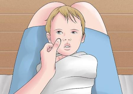 ریختن قطره در چشم نوزادان