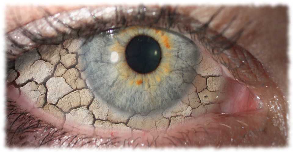 خشکی چشم