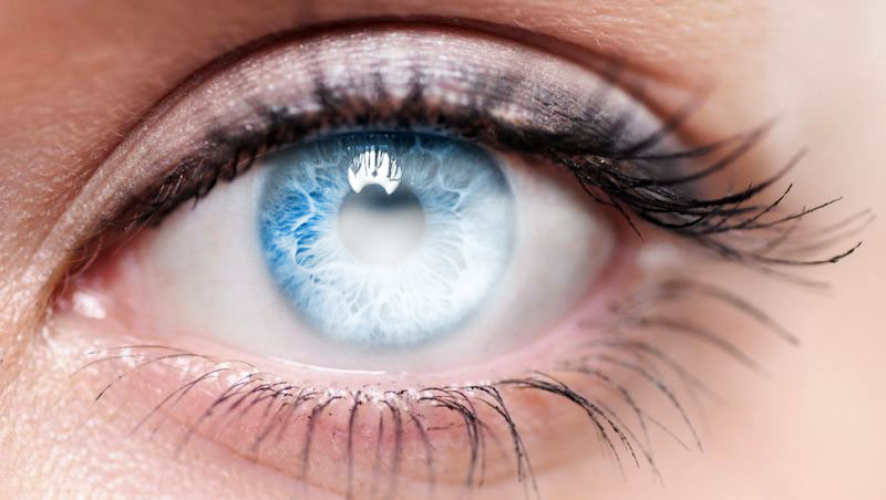 دیستروفی قرنیه