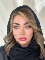 لنز رنگی فصلی یونیک Unique - Image 25