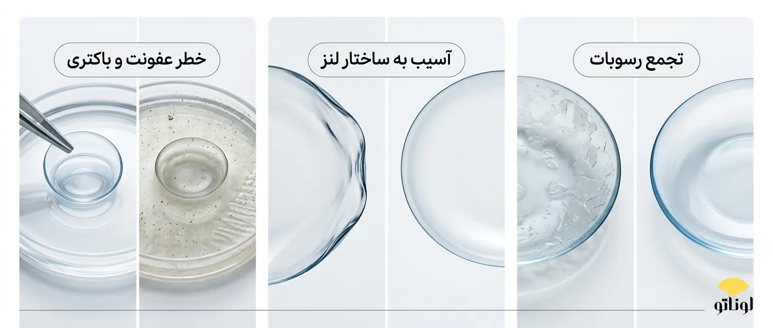 چرا نگهداری صحیح لنز اهمیت دارد؟