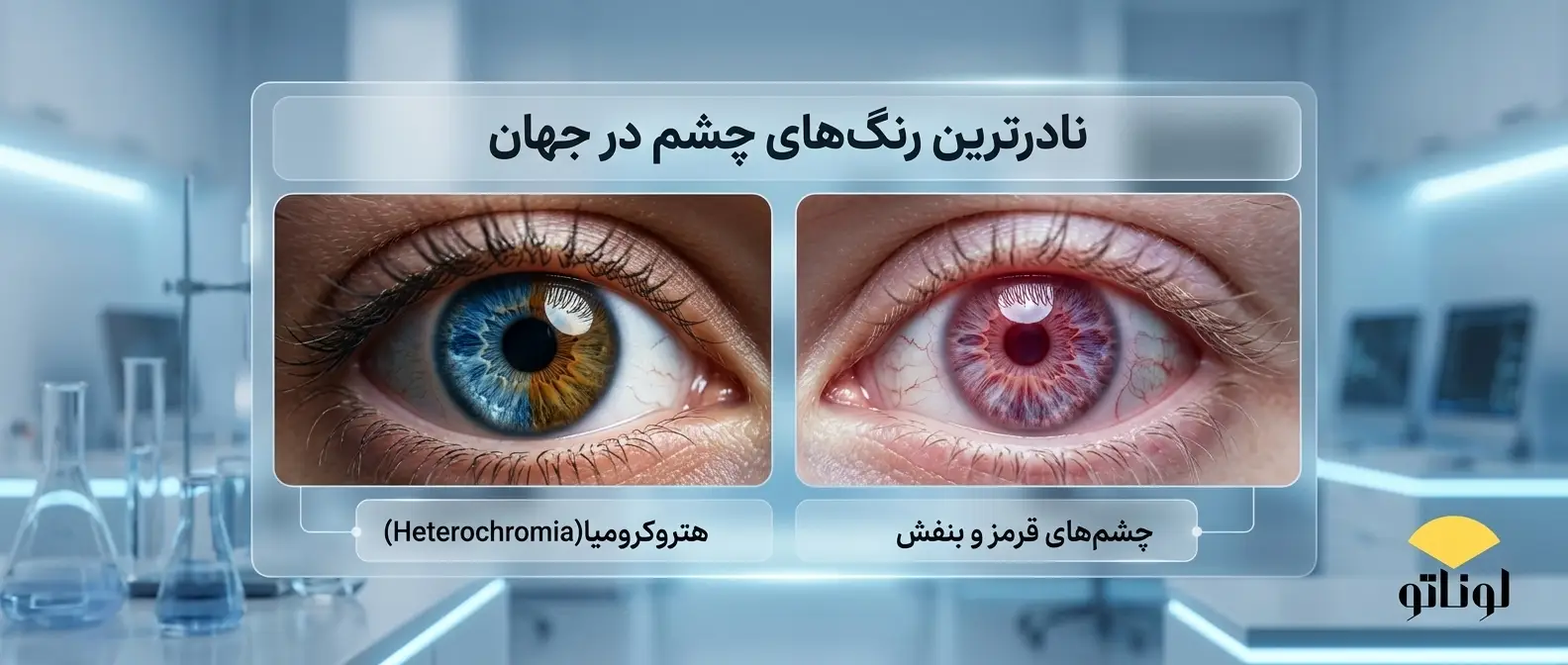 نادرترین رنگ‌های چشم در جهان